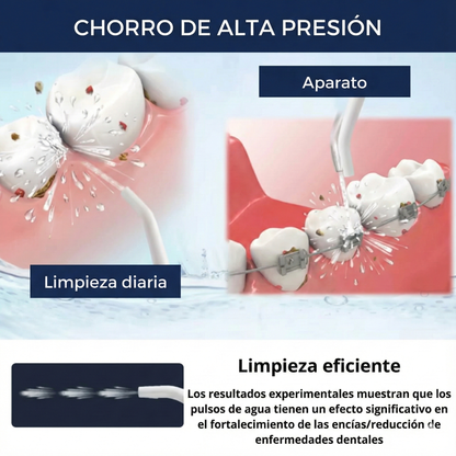JETFLOSS® Pro Irrigador Bucal: Sistema de Limpieza Dental Portátil 4 en 1 con Tecnología de Pulso Hídrico y 6 Boquillas